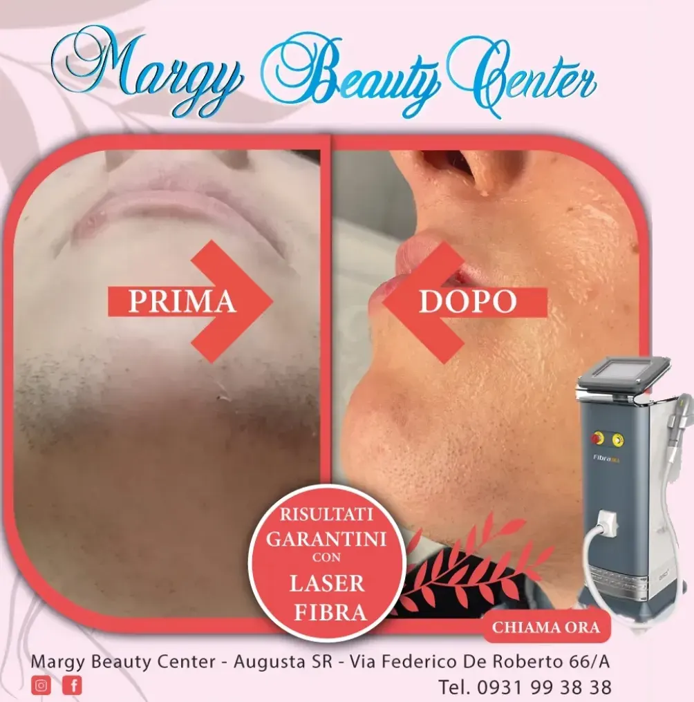Margy-beauty-center-Augusta-laser_v2